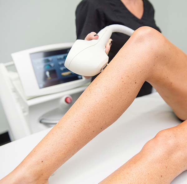 Venus Laser Hair Removal